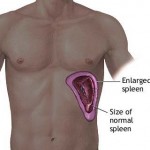 Spleen