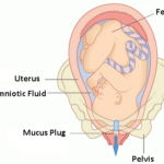 Mucus Plug
