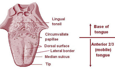 Lingual Tonsil Picture 1