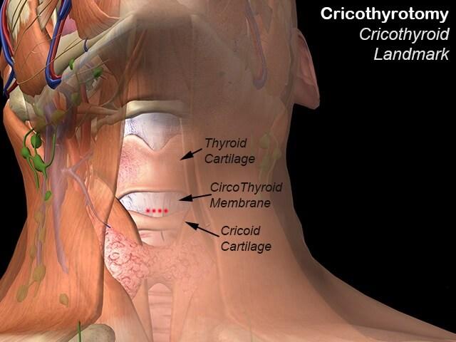 Cricoid Cartilage