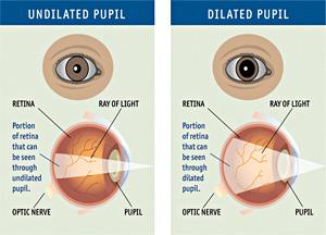 does zyrtec pseudoephedrine cause pupil constriction