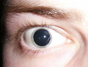Dilated Pupils Images