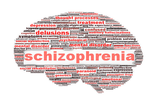 Catatonic Schizophrenia