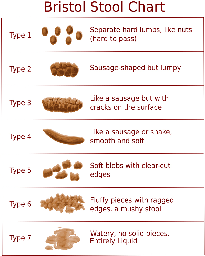 Types of Stool according to Bristol Stool Chart