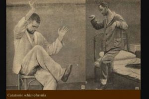 Catatonic Schizophrenia - Definition, What Is, Symptoms, Causes