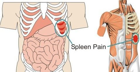 Spleen Pain location