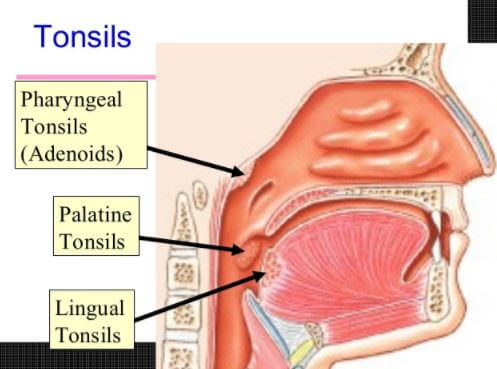 tonsils types lingual palatine pharyngeal